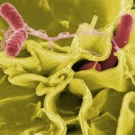 High Number Of People Dying From Tainted Food