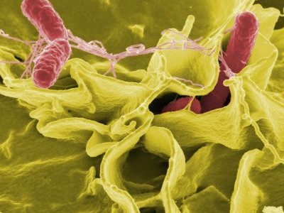 Salmonella Virus