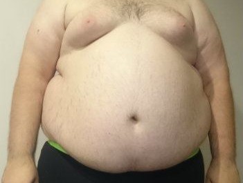 Obese Man