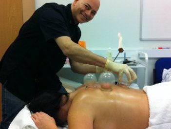 Fire cupping technique
