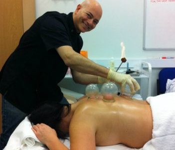 Fire cupping technique