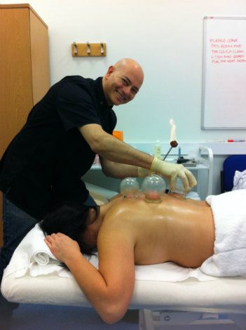 Fire cupping technique