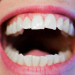 Top 6 Things To Know And Be Aware Of About Oral Cancer