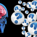 All About Alzheimer’s Disease